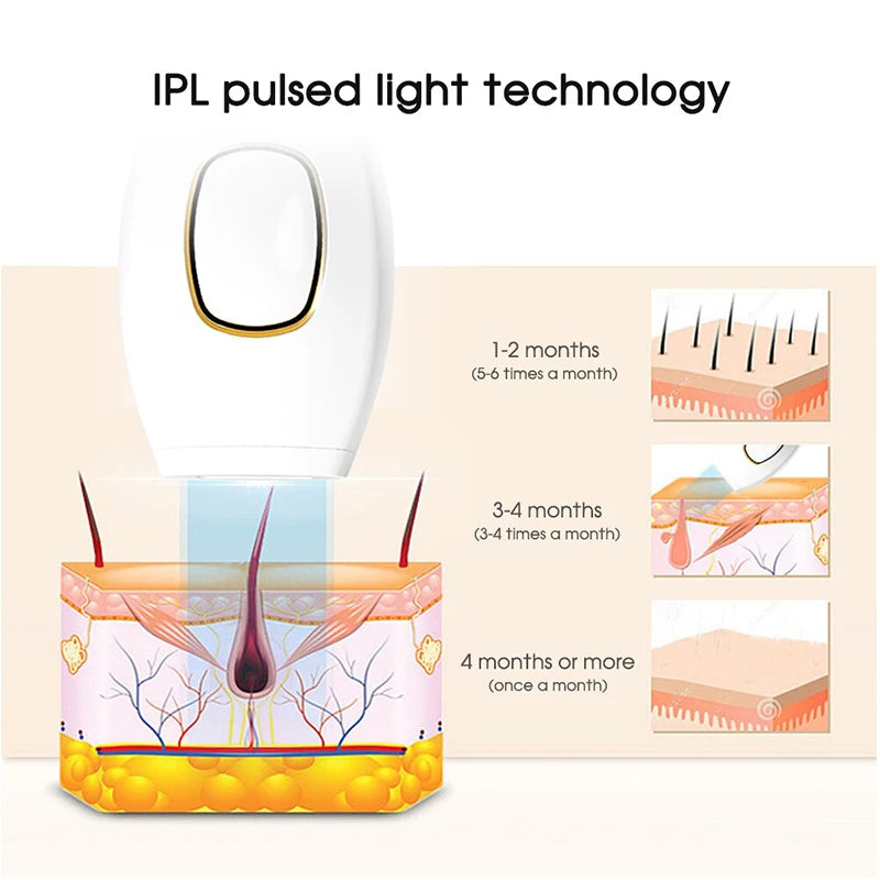 Lazerinis IPL epiliatorius namuose – ilgalaikis ir neskausmingas plaukų šalinimas