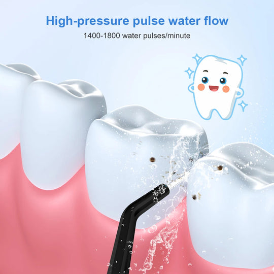 Išmanusis Dantų Iriklis (Water Flosser) INSMART – Giluminis Valymas ir Skaistesnė Šypsena!
